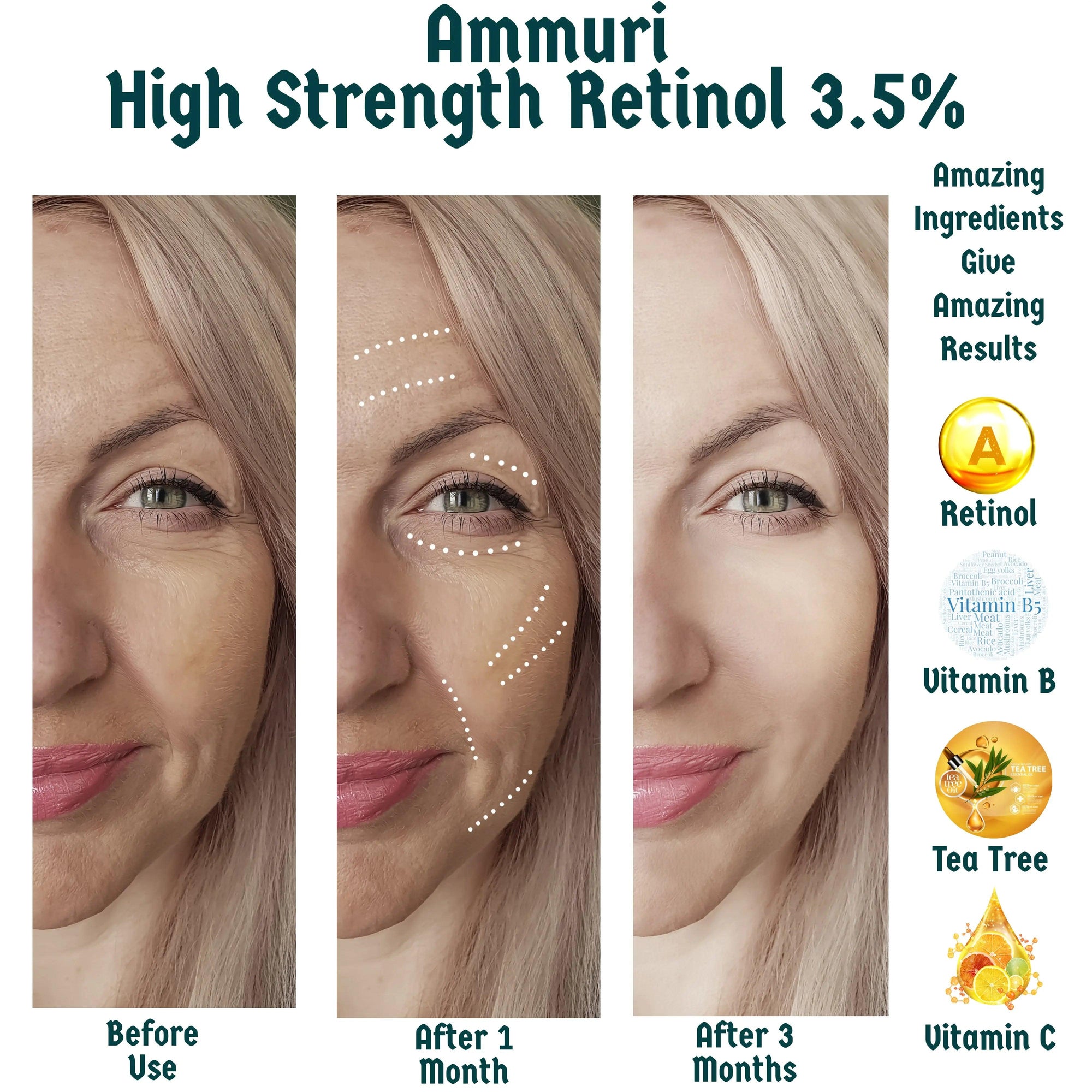 Ammuri 3.5% Retinol Face Serum | Fine Lines, Texture & Renewal | 30ml