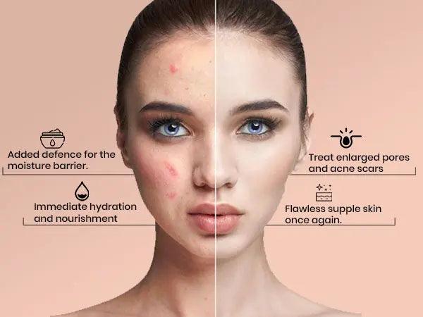 Ammuri Advanced Retinol 2.5% + Q10 Anti-Ageing Cream