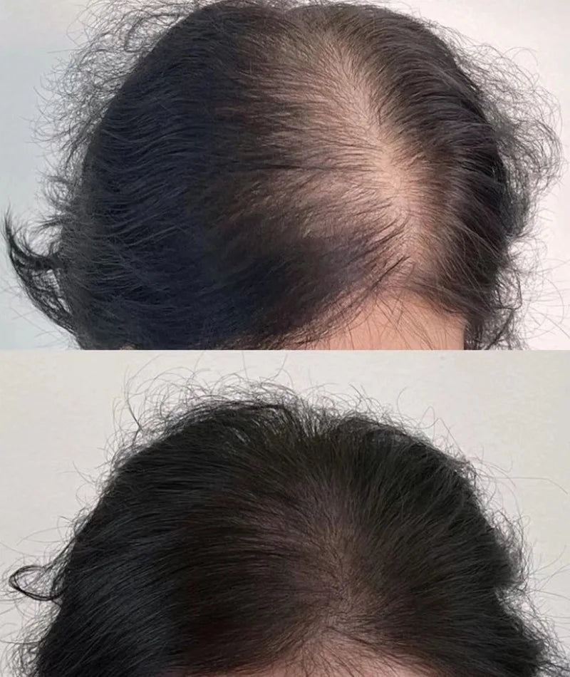 Lustrao Hair regrowth oil